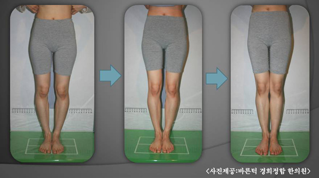 내토한의원 이미지