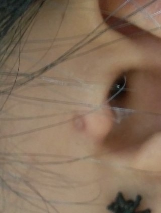 데드피어싱 이미지