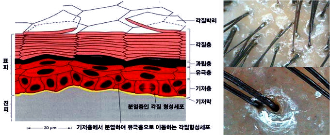 NK두피클리닉 이미지