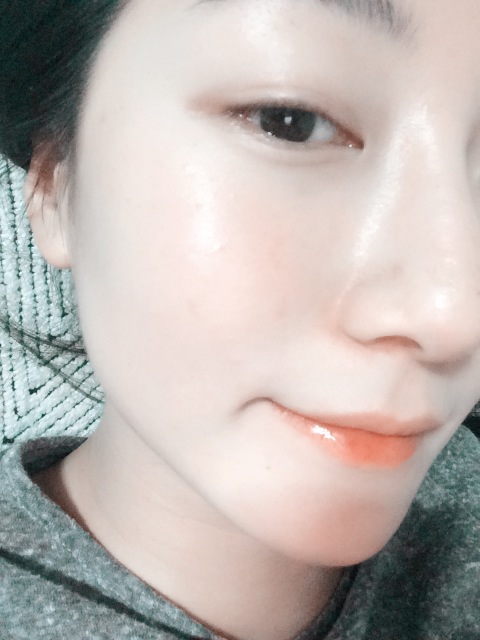 NK두피클리닉 이미지