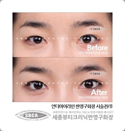 언더라인 이미지
