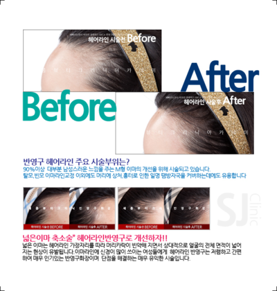 칼라헤어라인 이미지