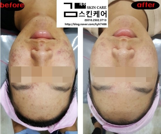 김채주스킨케어 이미지