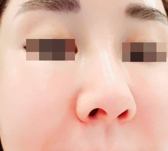 리페어플러스 이미지