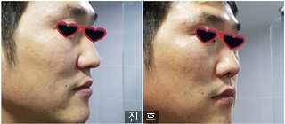 이노 스킨케어 이미지