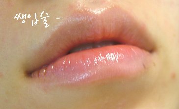 애드맥 이미지